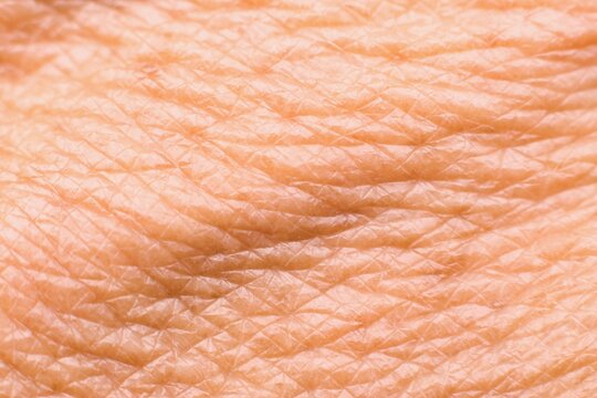 Detailed texture of the aging dry human skin