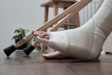 Broken leg in a plaster cast, near a crutches. Home rehabilitation after a broken leg.