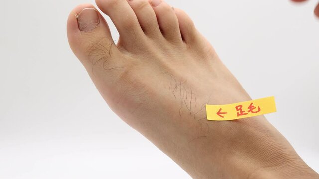 男性の足の甲の無駄毛