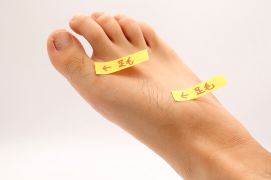 男性の足の甲の無駄毛