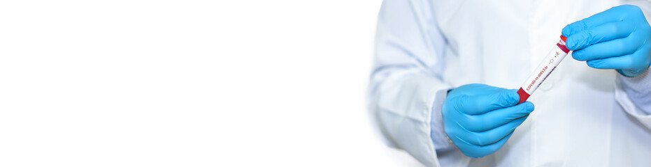 Fototapeta premium Doctor holding a test blood sample tube positive with delta variant or strain COVID-19. Banner. Copy space for text