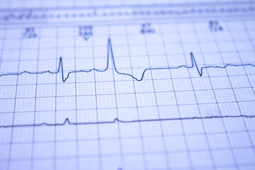 Close-up of an electrocardiogram with a heartbeat. Paper representation of heart arrhythmias.