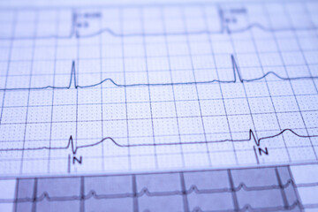 Close-up of an electrocardiogram with a heartbeat. Paper representation of heart arrhythmias.