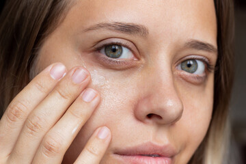 Close-up of face of a young beautiful caucasian blonde woman applying a moisturizing cream to the skin under the eyes on a dark background. Skin care, cosmetology