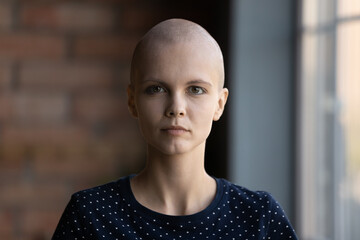 Young hairless cancer survivor head shot portrait, patient profile picture. Serious young woman with shaved head looking at camera. Oncology treatment, chemotherapy, hope and fight for life concept