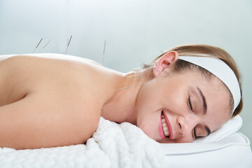 Doctor puts needles into female back on the acupuncture treatment therapy in spa salon. Alternative...
