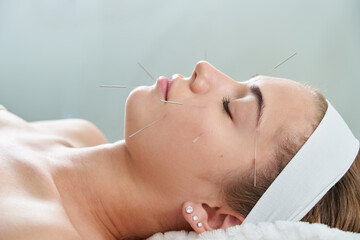 Young woman having an acupuncture treatment therapy on her face in spa salon. Alternative medicine...