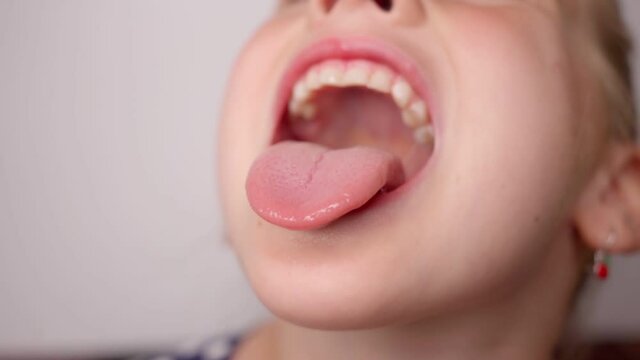 girl opens her mouth wide and pulls out long tongue. child shows his teeth and mouth to dentist. mouth is wide open, tongue is stuck out as far as possible, with clear view of tongue and soft palate