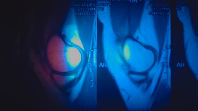 Magnetic resonance imaging (MRI) of the knee joint. Colorful illumination of the knee joint images. Closeup. Macro
