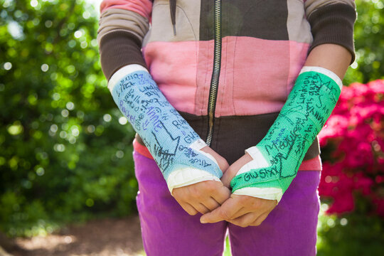 Girl (12-13) with two arm casts