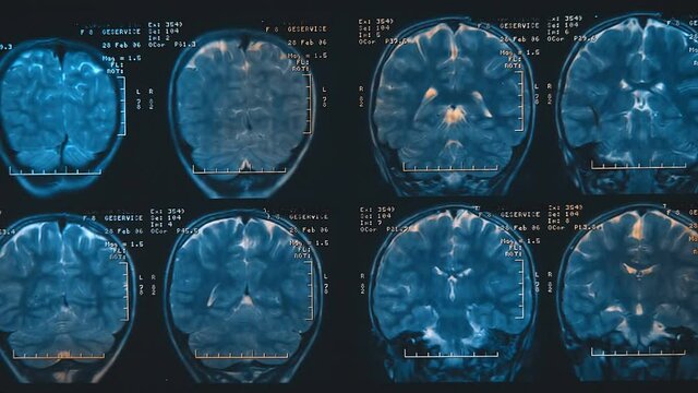 Magnetic resonance tomography (mri) of the human brain. Moving alphanumeric code through an image of brain slices. Closeup. Macro