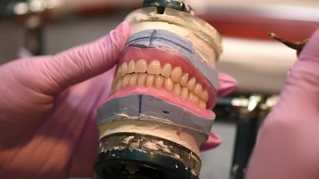 Modeling the installation of a denture with wax. Plaster and plastic impression of the dental arch and jaw. Dental technician creates removable orthodontic prosthesis with pink gum. 