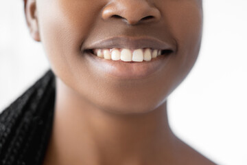 Healthy smile. Dental care. Dentistry wellness. Oral hygiene. Unrecognizable closeup of fresh young African woman face with wide grin perfect clean teeth isolated on white.