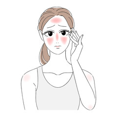 女性　美肌　肌トラブル　美容　スキンケア　日焼け　赤い肌　悩む顔　困り顔　タンクトップ