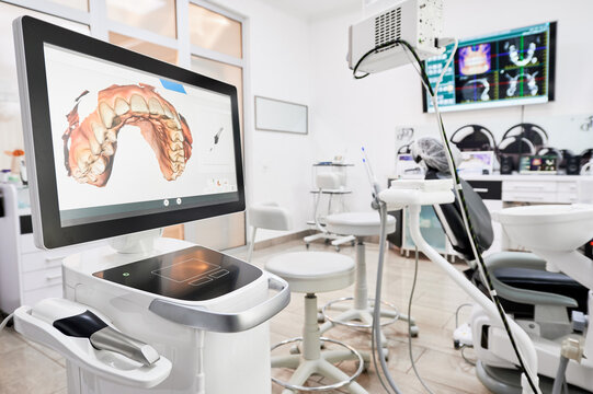 Interior Of Dental Office With Modern Equipment And Dental Intraoral Scanner With Teeth On Display, Medical System For Intraoral Scanning. Concept Of Digital Dentistry And Dental Scanning Technology.