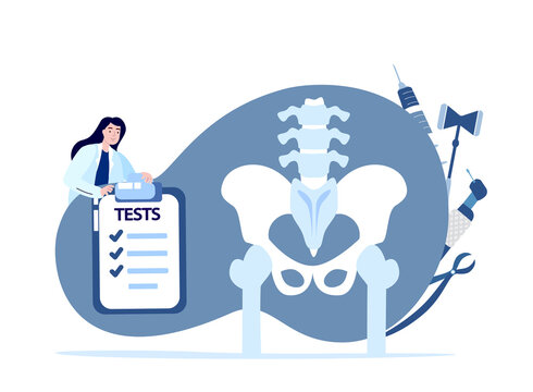 Woman Doctor traumatologist orthopedist analyzes Hip Joint.Arthoplasty, Osteoarthritis, Hip Joint Replacement. Tiny Character at Huge Human Pelvic Bones with Implant.Cartoon People Vector Illustration