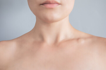 Obraz na płótnie Canvas Swollen supraclavicular node. Lump on the clavicle. Fluid-filled lump associated with a tumor or a swollen lymph node.
