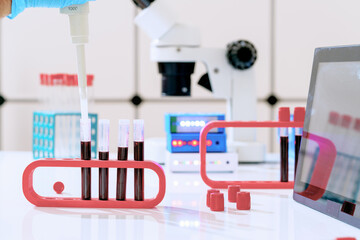 Blood test for hormones and microelements in a biochemical laboratory. Test tubes with blood in the hand of a laboratory assistant and a microscope on the background