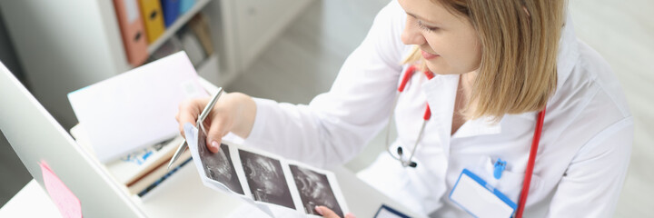 Doctor holds in his hands result of examination of embryo