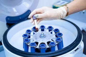 Scientist putting samples into centrifuge. Modern biotechnology equipment.