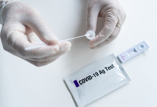 Test tube with biological solution for tests for coronavirus. hands in white medical gloves hold a test tube and a wand for analysis. Protect yourself from the virus. COVID-19 pandemic.