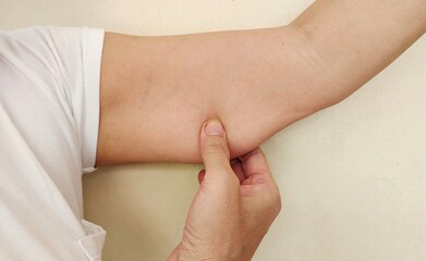 Women's hand pulling underarm of saggy skin.