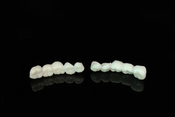 Long dental zirconia bridge with all porcelain baked