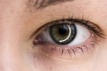 Obraz premium The human eye is green with inflamed vessels.