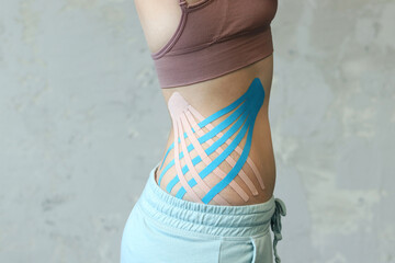Cosmetology kinesio tapes on young woman waist closeup photography. Body care modern treatment for...