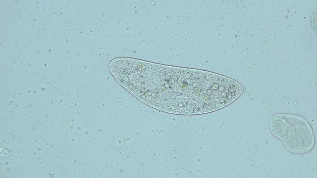 infusorium Ciliophora of the genus Paramecium under a microscope, order Peniculida. Cilia help to move, feeds on bacteria and other small organisms. Planktonic organism