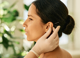 Woman having ear acupressure or ear acupuncture for her diseases treatment, side view. Acupuncture, reflexology, traditional Chinese medicine - obrazy, fototapety, plakaty