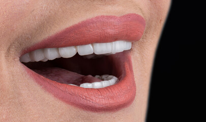 Obraz premium press ceramic crowns and veneers