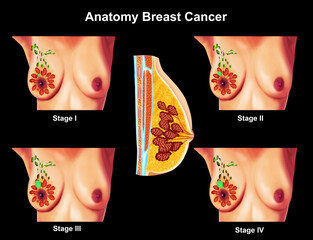 Anatomy breast cancer