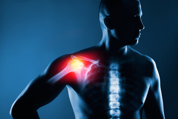 Fototapeta premium Human shoulder joint in x-ray on blue background