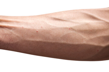 rash on arm and white background