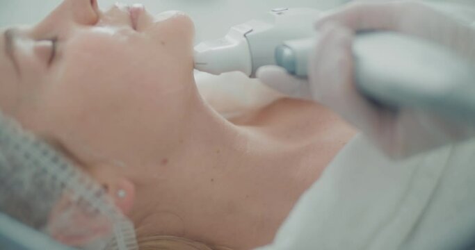 A female client with cream on her face is having a SMAS lifting procedure by using the Ultraformer apparatus. Close-up cheek, skin, face, eyes, neck.