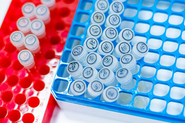 Rack of test tubes in medical laboratory
