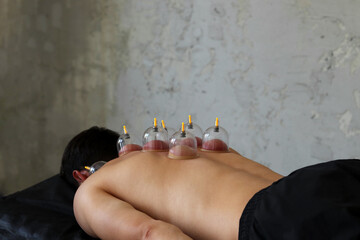 Cup massage close up. Сans for massage on the man's back. Massage with vacuum cups.