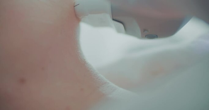 A female client is having a SMAS lifting procedure by using the Ultraformer apparatus. Close-up neck.