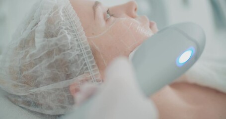 Close-up female face, she is having SMAS face-lifting procedure on her cheek by using Ultraformer apparatus.