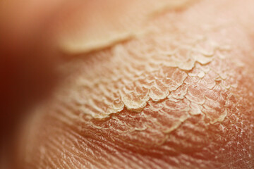 Fototapeta premium Macro of dry foot skin