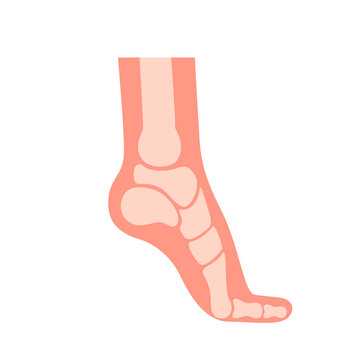 Silhouette human foot with bones, orthopedic leg, healthy feet. Foot deformation, defect, pathologies of foot, flat foot. Supination and pronation. Vector illustration