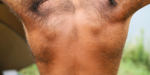 Back of a very hairy man without a shirt .