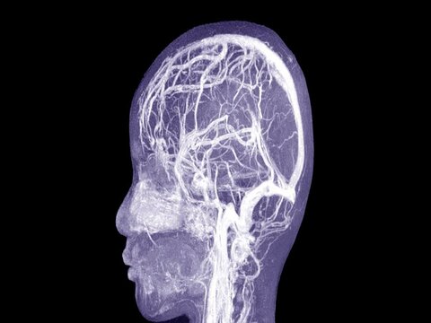 Magnetic resonance imaging mri of the human brain. Closeup. Medical technology concept.