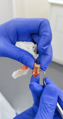 Obraz premium Tooth removed in dental clinic with caries