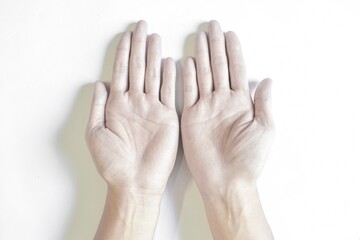 Pale palmar surface of hands. Anaemic hands of Asian man. - obrazy, fototapety, plakaty
