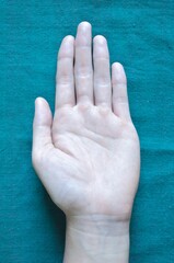 Pale palmar surface of hand. Anaemic hand of Asian man. - obrazy, fototapety, plakaty