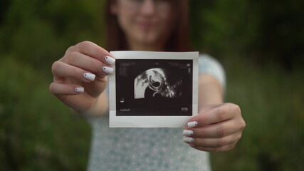 A young pregnant woman holds an ultrasound picture of a baby in her hands. Girl in nature.