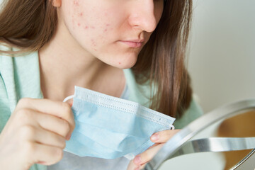 Faceless woman having pimples and blackheads after wearing protective medical mask. Girl looking at...