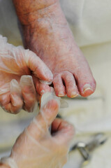 Fototapeta na wymiar Podiatrist works on elderly patients feet.